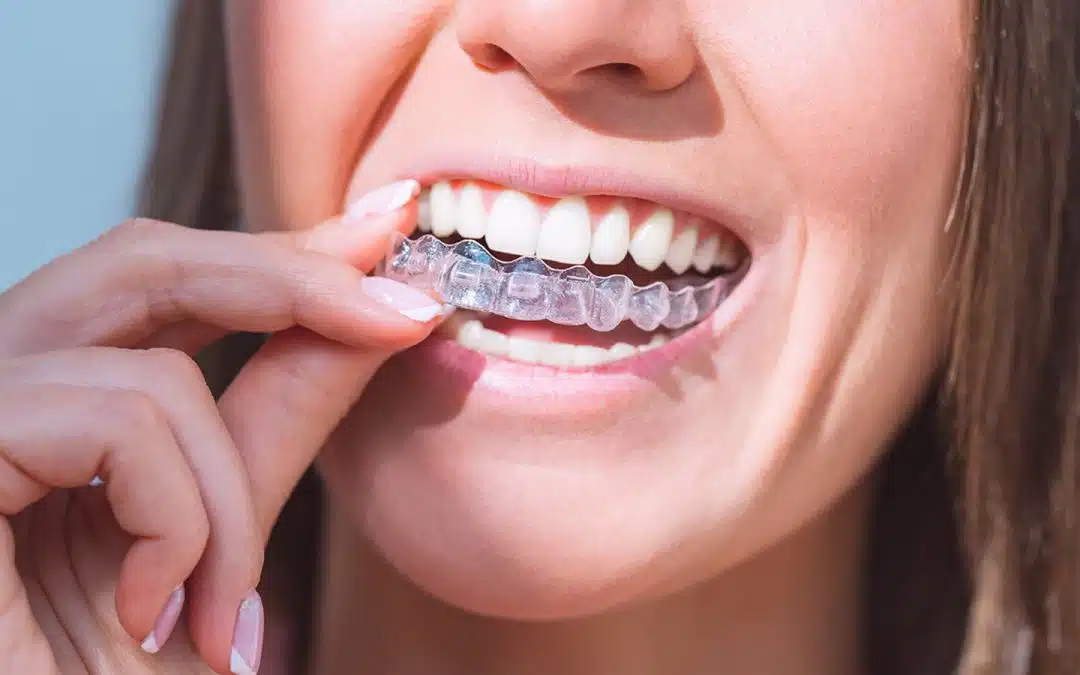Experience World-Class Care with a Dentist Near Me for Optimal Dental Health